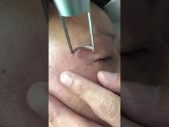 450ps পিকোসেকেন্ড লেজার মেশিন 1064nm 532nm Q সুইচড Nd Yag