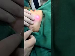 পেশাদার 1470nm ডায়োড লেজার ফ্যাট রিডাকশন মেশিন 2-3 সেশনের মধ্যে দৃশ্যমান ফলাফল