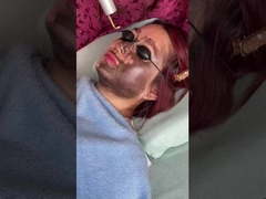 ফেস লিফট 585nm 650nm পিকোসেকেন্ড লেজার ডিভাইস 500ps 750ps 2000ps